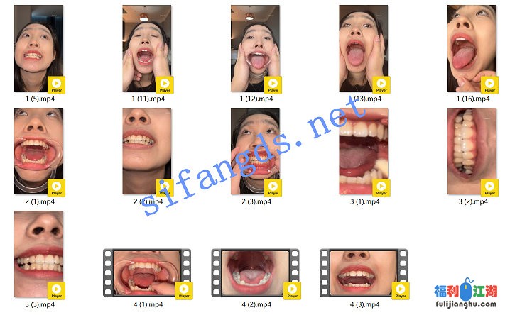 ஐ恋物癖ஐ【4K】摄影师约拍平模张萌 最新口腔牙齿定制14V[某房原版]【5.4G】
